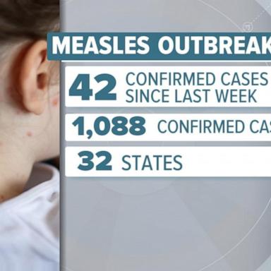 VIDEO: Measles cases top 1,000 in US