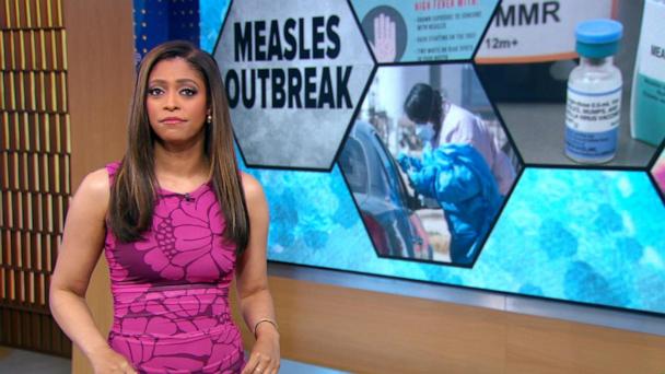 CDC warns travelers amid measles spike