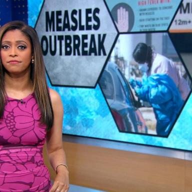 VIDEO: CDC warns travelers amid measles spike