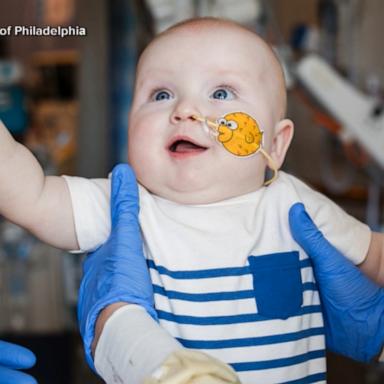 VIDEO: ‘Miracle’ baby saved by medical breakthrough goes home