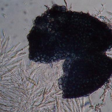 VIDEO: 2 Chinese nationals charged with smuggling dangerous fungus into US
