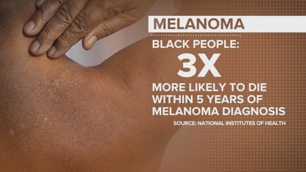 Skin cancer warning for people of color