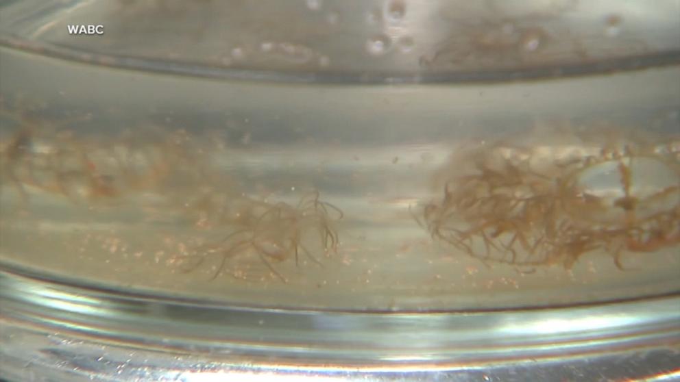 VIDEO: Scientists warn of invasive jellyfish on East coast