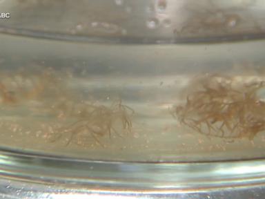 WATCH:  Scientists warn of invasive jellyfish on East coast