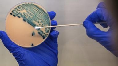 VIDEO: Cyclosporiasis cases rise in 31 states