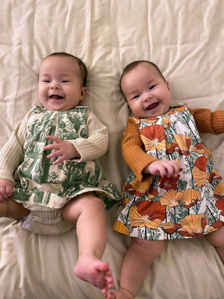 PHOTO: Cara Lestenkof-Mandregan's twin daughters Anna and Mila were born in Anchorage, Alaska.