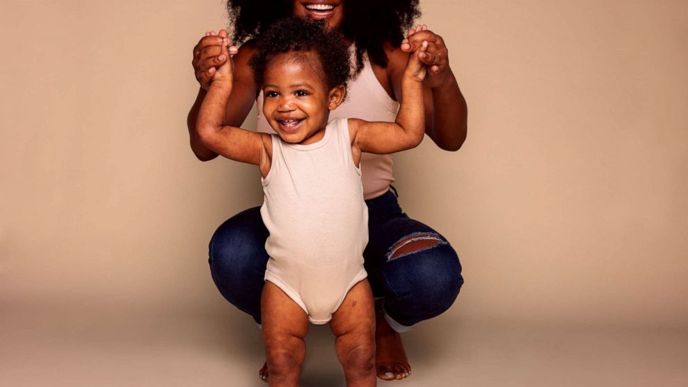 PHOTO: Aveeno is shedding light on Black skin health inequities through its #SkinVisibility campaign.