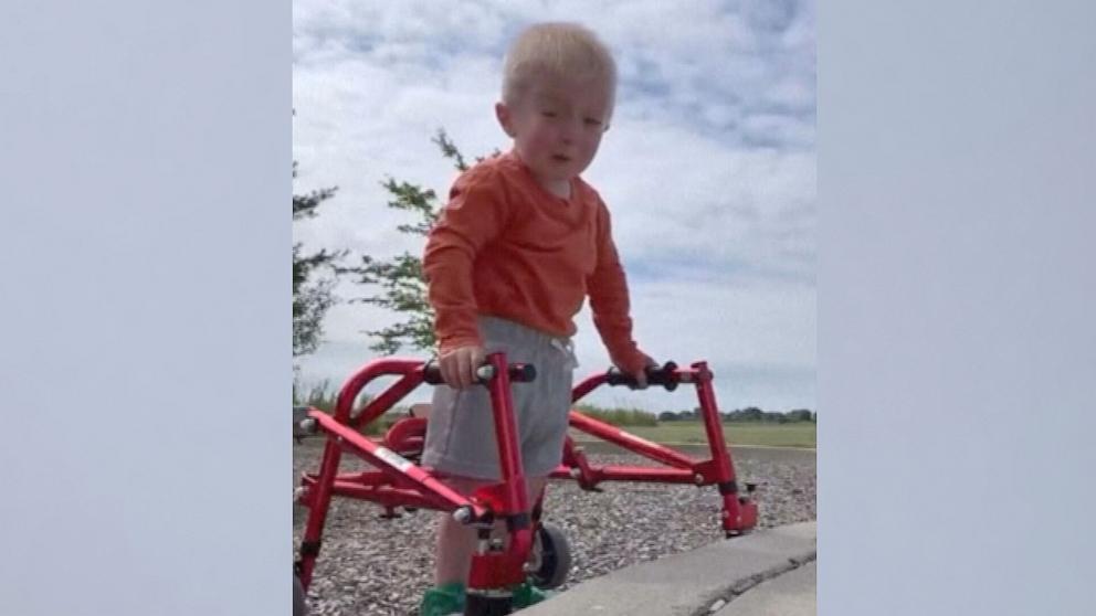 PHOTO: Bedford Erickson, 3, has captured the hearts of hundreds of thousands of followers on social media who follow his journey living with a rare condition called Schwartz-Jampel syndrome.