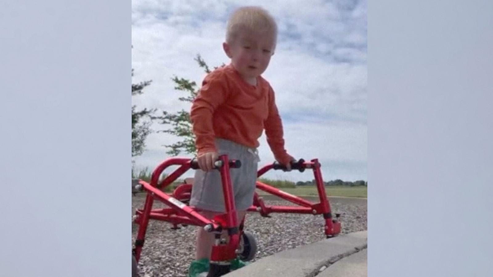 PHOTO: Bedford Erickson, 3, has captured the hearts of hundreds of thousands of followers on social media who follow his journey living with a rare condition called Schwartz-Jampel syndrome.