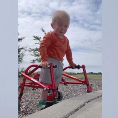 PHOTO: Bedford Erickson, 3, has captured the hearts of hundreds of thousands of followers on social media who follow his journey living with a rare condition called Schwartz-Jampel syndrome.