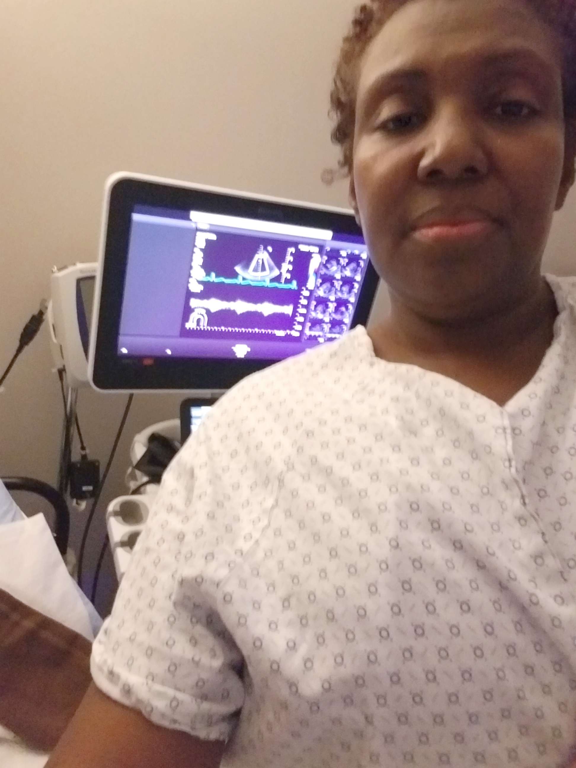 PHOTO: Carletha Cephas during a hormone therapy appointment in Los Angeles, Calif., in December 2018. 