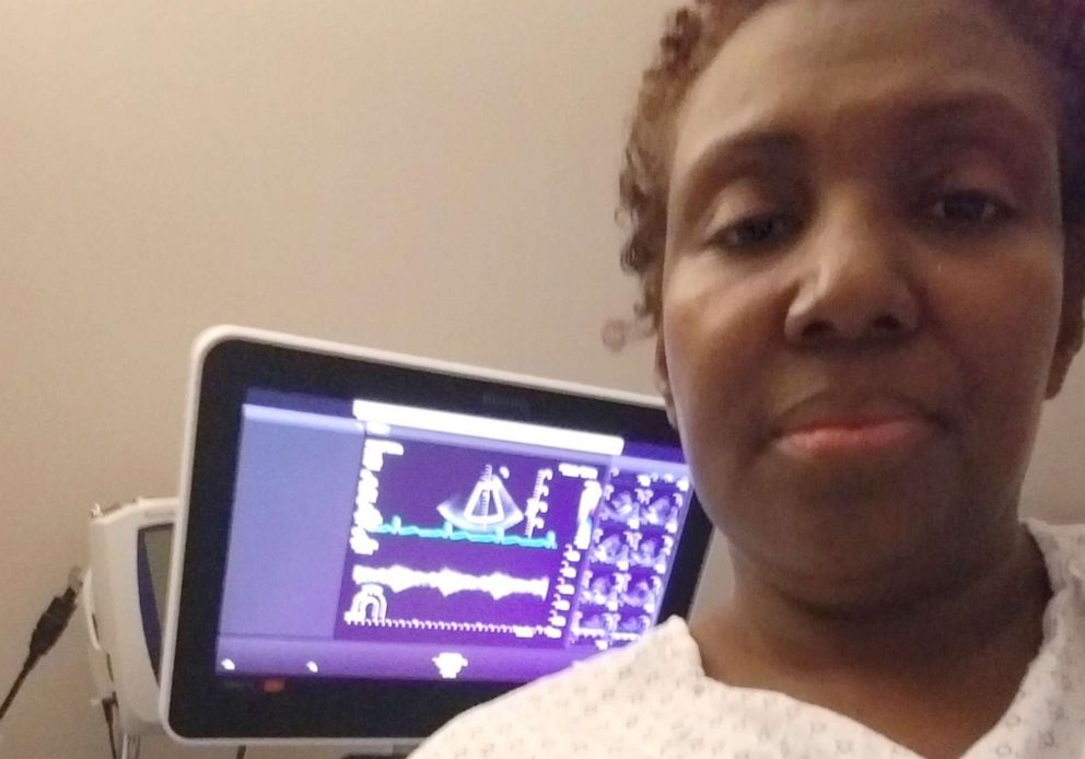 PHOTO: Carletha Cephas during a hormone therapy appointment in Los Angeles, Calif., in December 2018. 