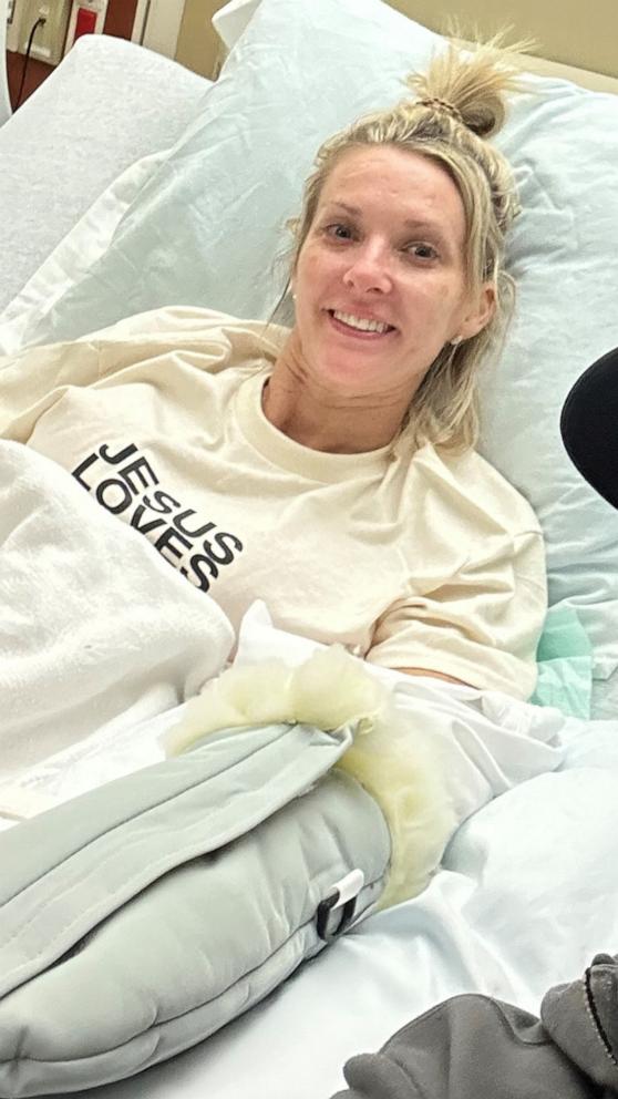 Mom has limbs amputated after going into septic shock following kidney stone  surgery - Good Morning America