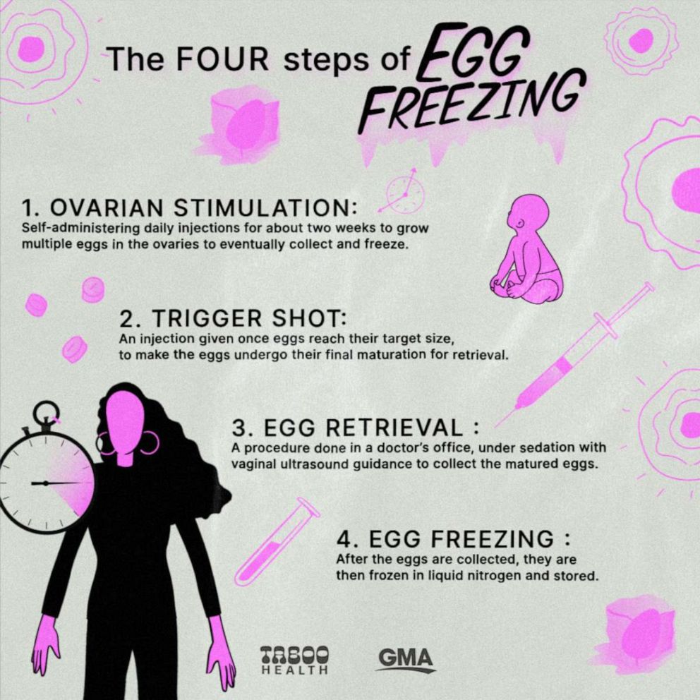 The egg freezing process involves four steps, from ovarian stimulation to the storing of eggs.