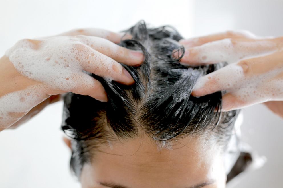 PHOTO: Woman is washing her hair with shampoo