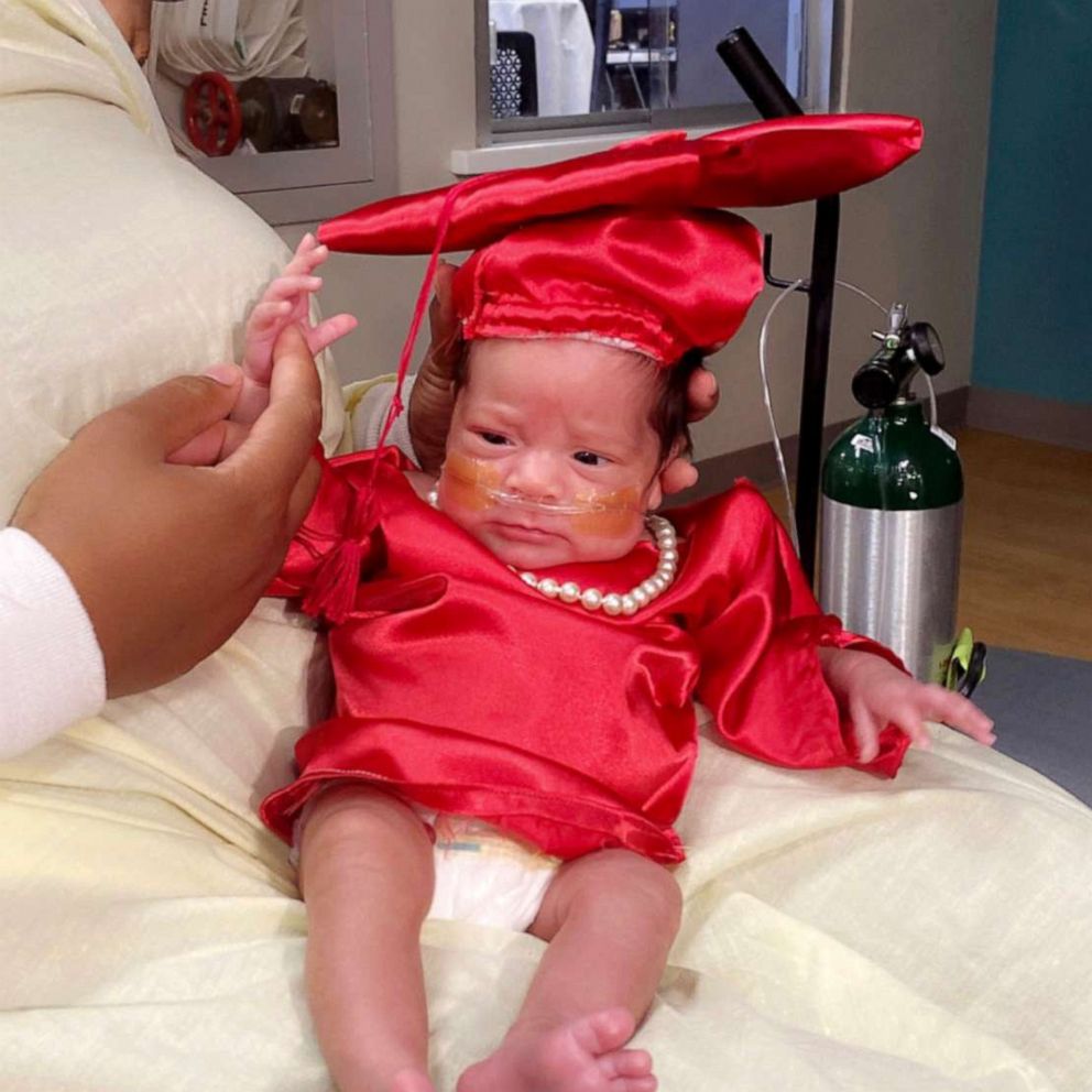 VIDEO: Baby gets a farewell graduation ceremony after 80 days in the NICU