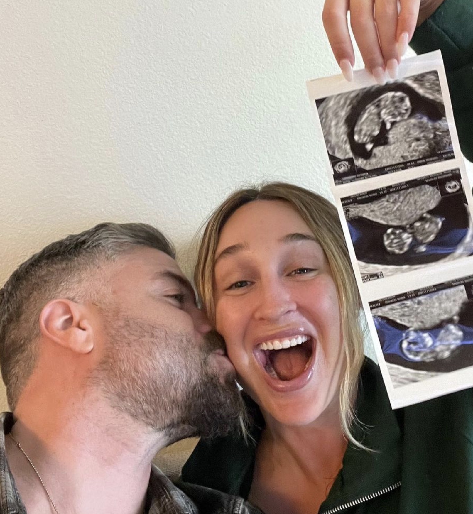 Pregnant Influencer In Medically Induced Coma After Suffering Aneurysm Week  Before Due Date