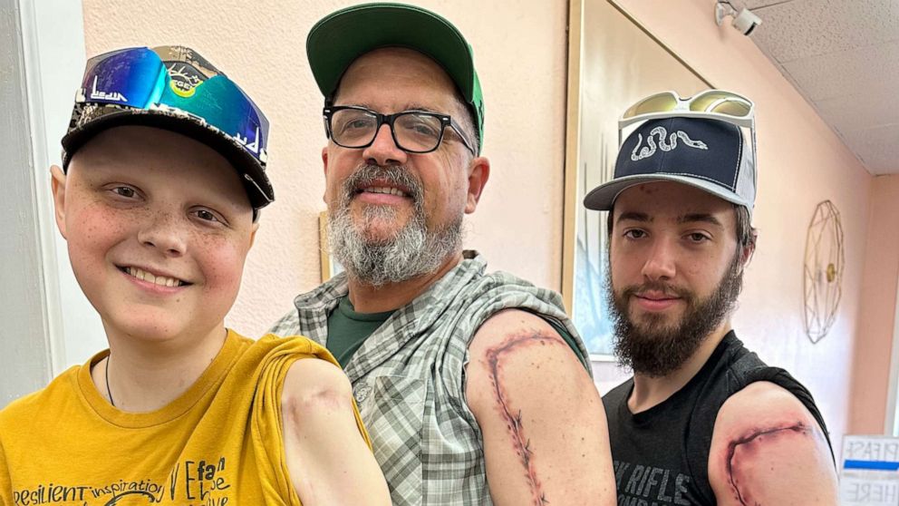 VIDEO: Family gets matching scar tattoos to honor teen going through cancer