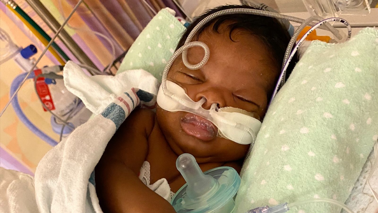 PHOTO: Newborn Kamiya Allen hospitalized with a Respiratory Syncytial Virus (RSV) Infection.