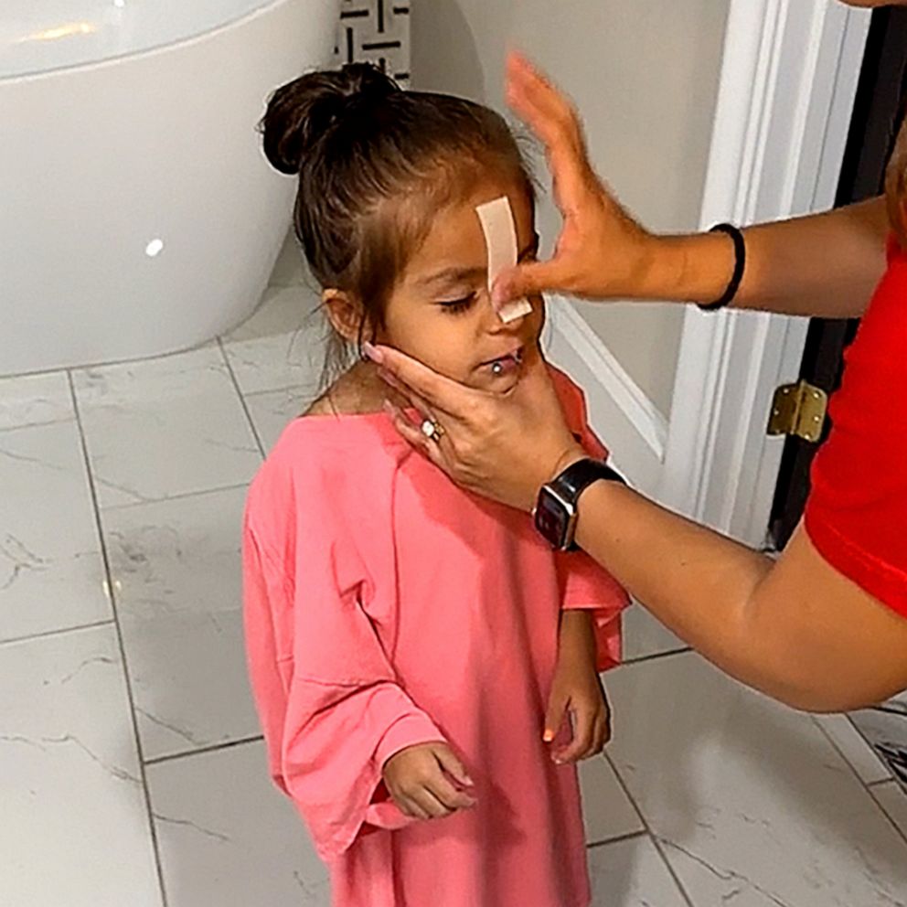 VIDEO: Mom defends waxing 3-year-old’s eyebrows, experts weigh in