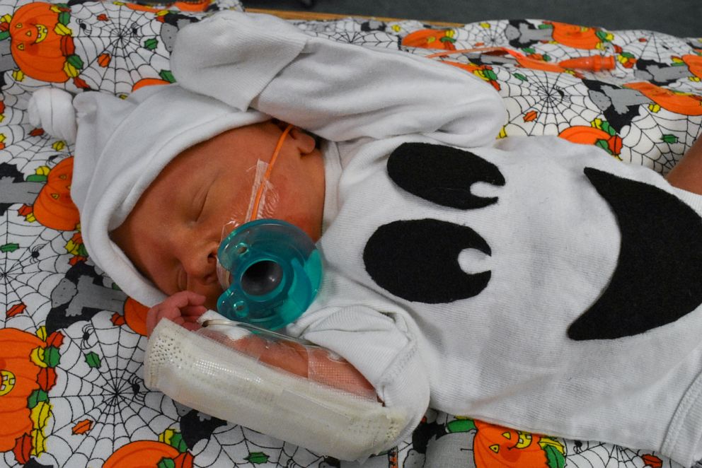 PHOTO: Baby from the Tallahassee Memorial HealthCare NICU dressed in a ghost Halloween costume.