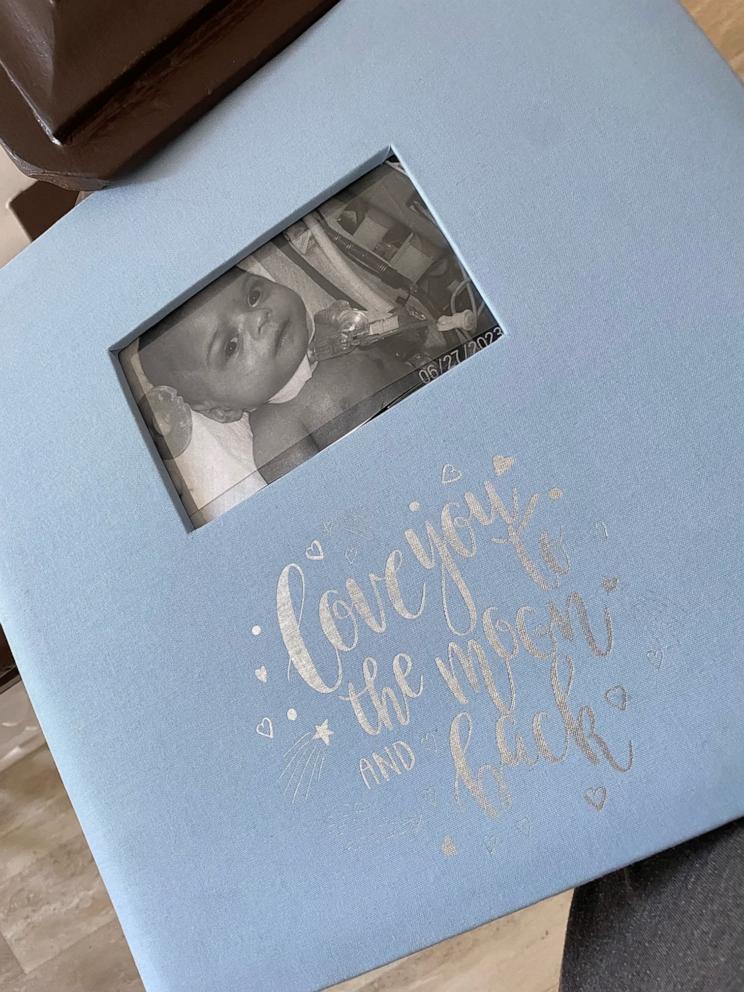 PHOTO: While Nathaniel was in the hospital, his mother, Sandya Flores, kept a scrapbook full of photos, milestones and more.