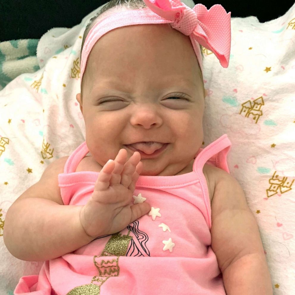 VIDEO: Micro preemie who spent 122 days in NICU reunites with staff who saved her