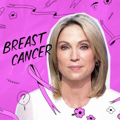 PHOTO: ABC News' Amy Robach speaks about her journey since being diagnosed with breast cancer in 2013.