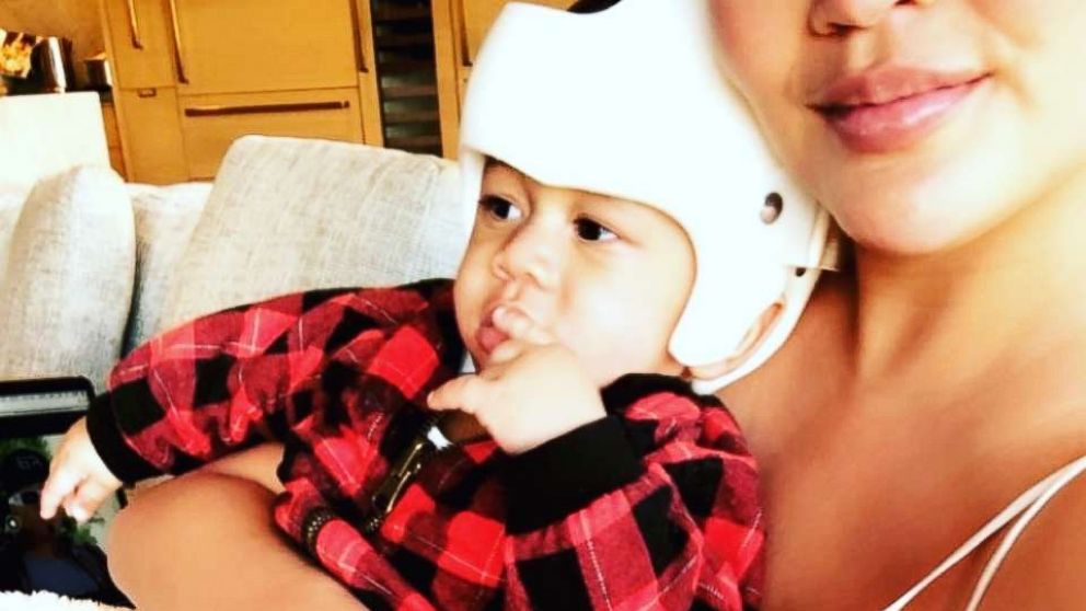 VIDEO: Chrissy Teigen responds to backlash over photo of her baby in a helmet 