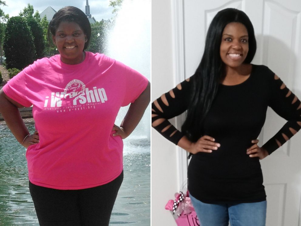 PHOTO: Tiesha Robinson, of Statesville, North Carolina, lost over 200 pounds.