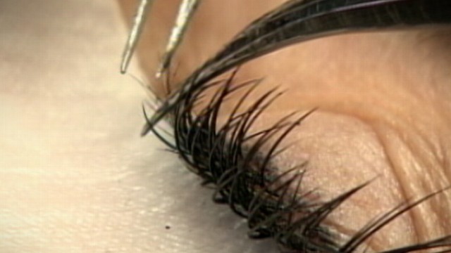 Eyelash Extensions Health Risk: Allergies, Loss of Lashes Possible