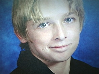 VIDEO: The burned boy recalls the horrific incident that letf him scarred.