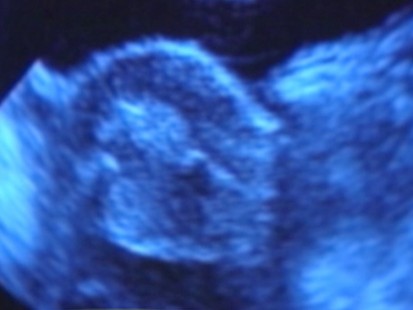 VIDEO: fertility clinic mix ups