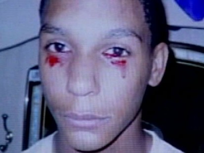VIDEO: 15-year-old in Tennessee deals with a mysterious medical condition.