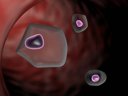 Human papillomavirus (HPV) has now been linked to oral cancer.