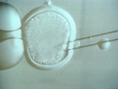 VIDEO: Stem Cell Breakthrough