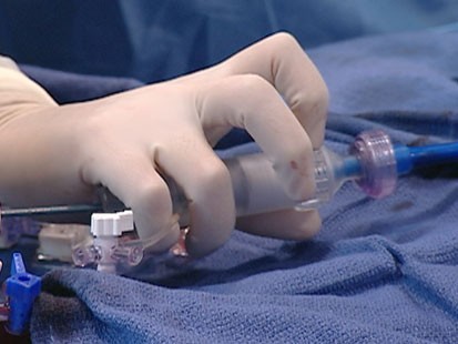 VIDEO: The newly developed valve for heart care.