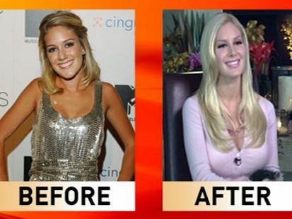 VIDEO: Many viewers object to the reality TV stars plastic surgery.