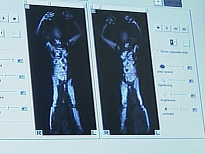 VIDEO: Do full body scanners violate a traveler?s civil liberties?