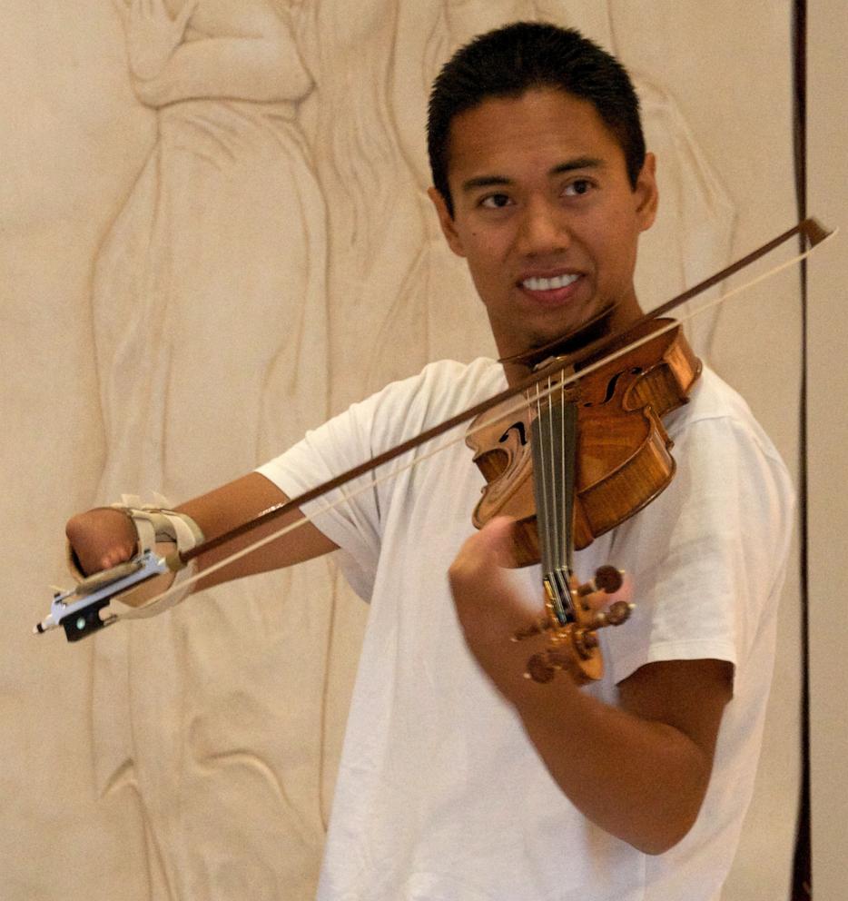 PHOTO: Adrian Anantawan picked up the violin in the fifth grade. His family worked with engineers to create a device that would allow him to hold the bow and play with his shoulder.