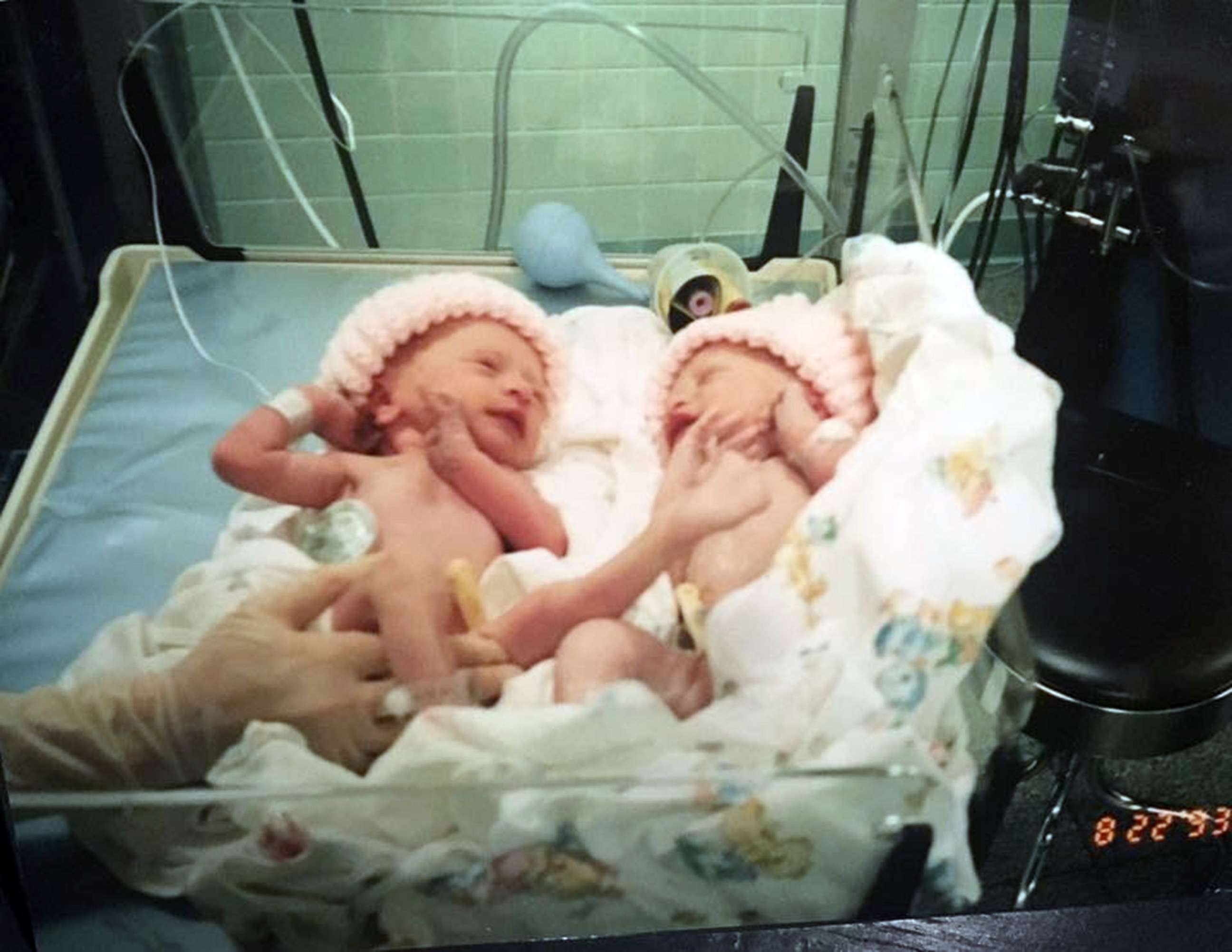 PHOTO: Twins Jaci and Alex Hermstad were born on Aug. 22, 1993.