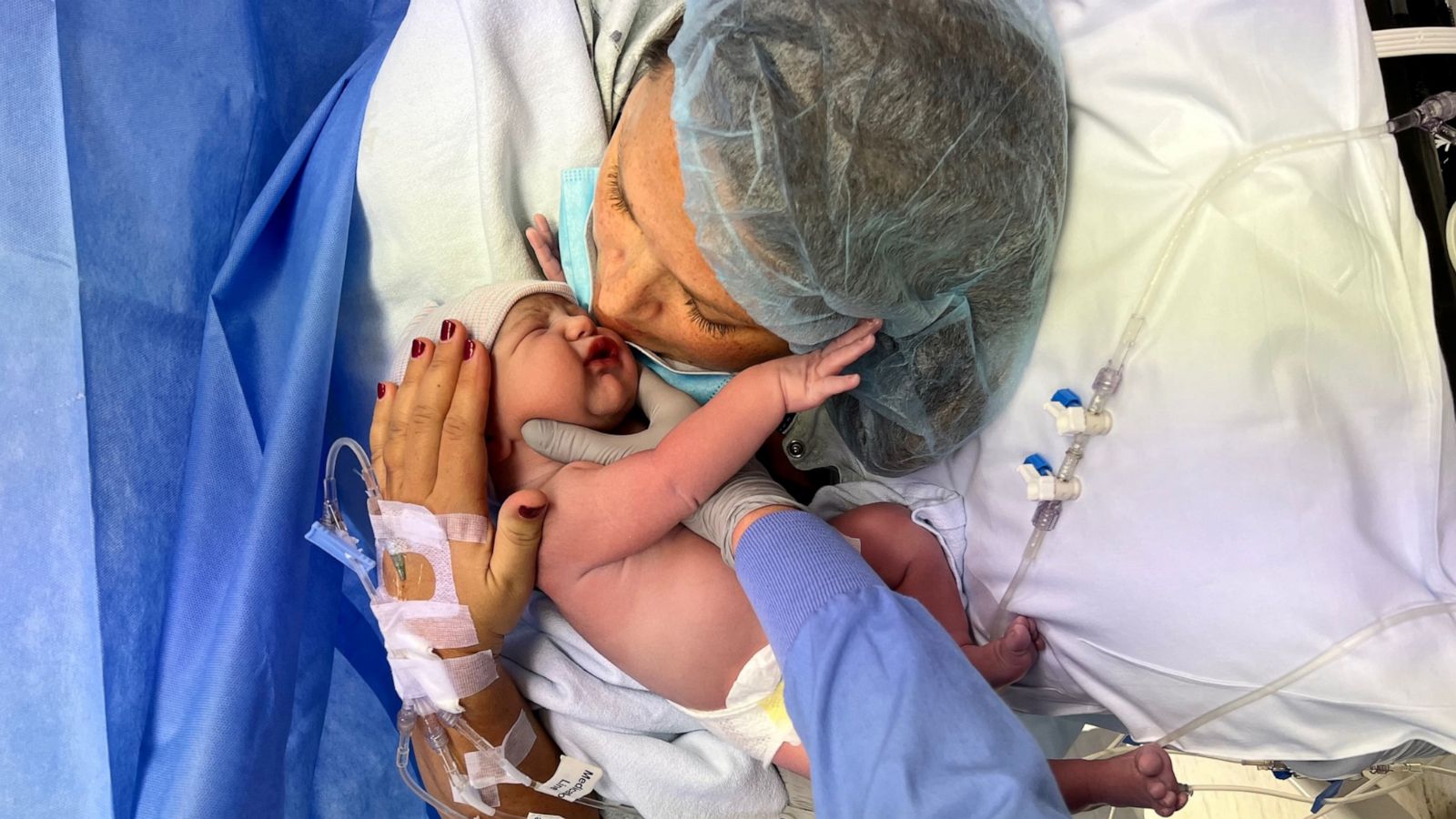 PHOTO: Amanda Koop was able to watch the c-section birth of her son via a camera and screen in a delivery room at Spectrum Health Butterworth Hospital in Grand Rapids, Michigan.