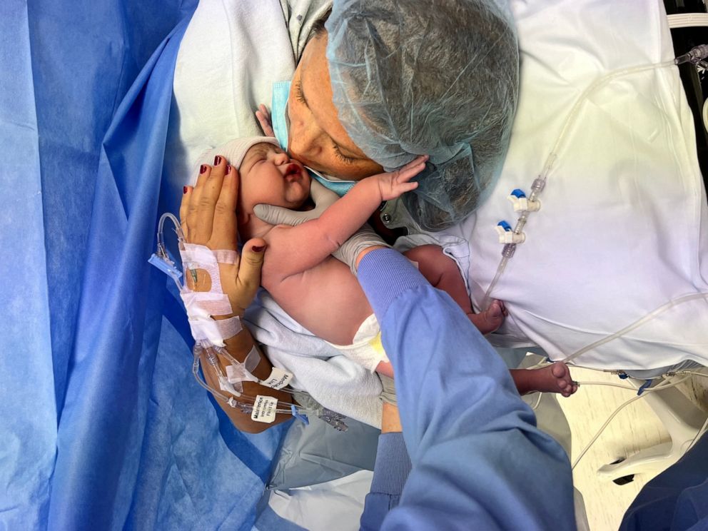 PHOTO: Amanda Koop was able to watch the c-section birth of her son via a camera and screen in a delivery room at Spectrum Health Butterworth Hospital in Grand Rapids, Michigan.