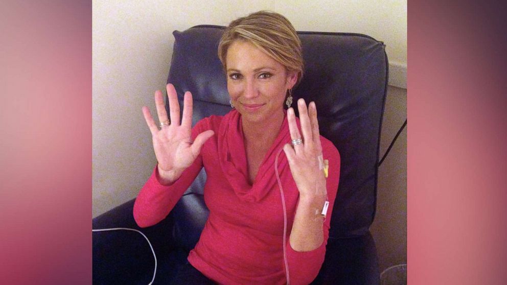 PHOTO: ABC News' Amy Robach poses while undergoing chemotherapy for stage 2 invasive breast cancer in 2013.