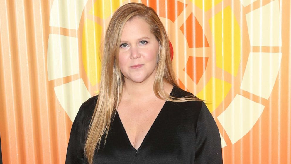 Amy Schumer talks about the pressure to breastfeed: 'This is not for me ...