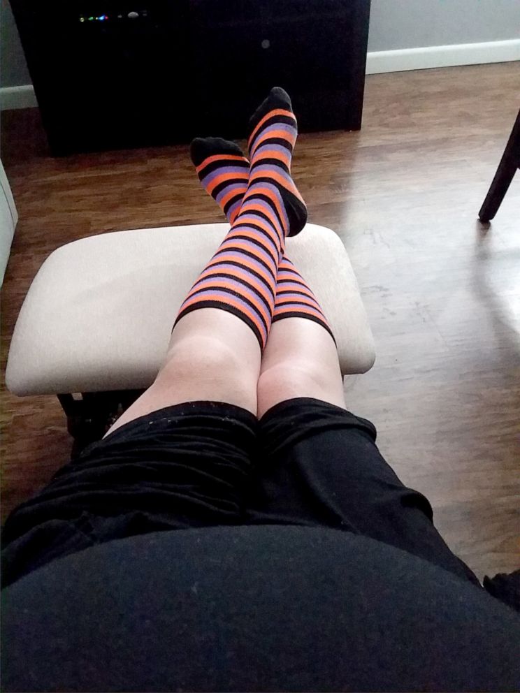 PHOTO: Angela Hertenstein is known as the "rainbow sock lady" for wearing her lucky socks to doctors' appointments.
