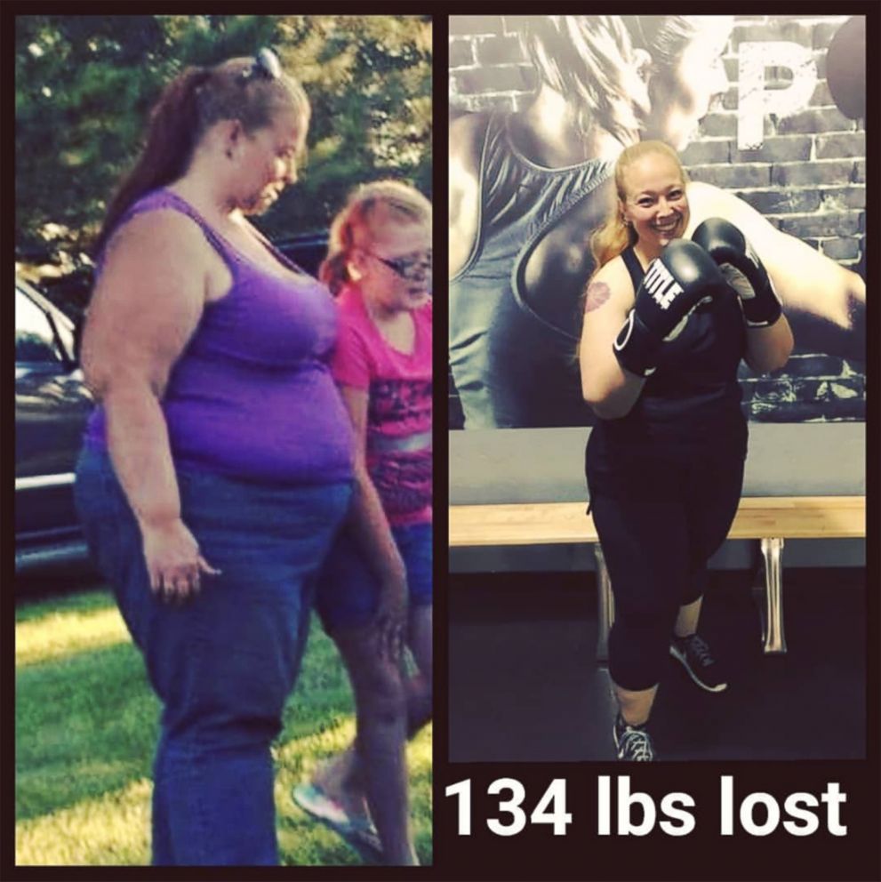 PHOTO: Angie Phillips shared these images from her weight loss journey after losing 134 pounds.