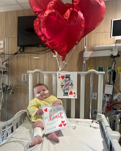 Baby celebrates 1st birthday after undergoing heart transplant