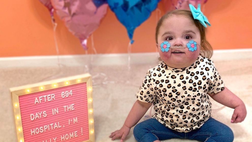 PHOTO: Valentina Garnetti was diagnosed in utero with hypoplastic left heart syndrome. The 1-year-old remained in University of Michigan's CS Mott Children's Hospital in Michigan, since the day she was born.