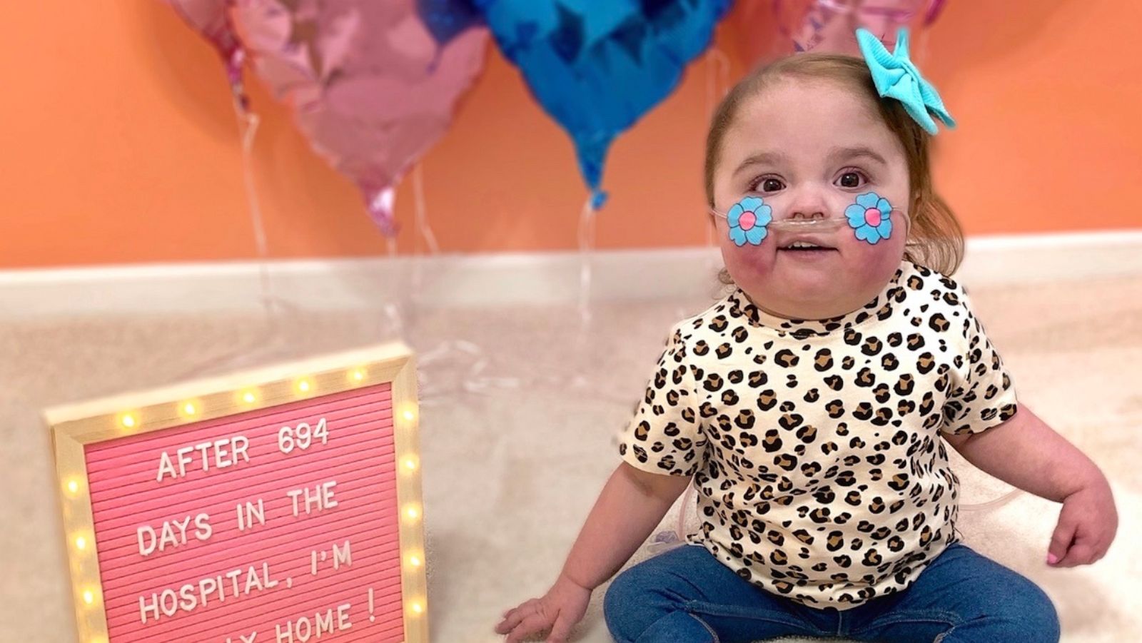 PHOTO: Valentina Garnetti was diagnosed in utero with hypoplastic left heart syndrome. The 1-year-old remained in University of Michigan's CS Mott Children's Hospital in Michigan, since the day she was born.